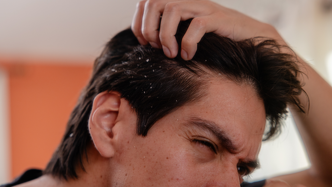 What kind of flakes do you have?